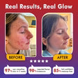 7 Farben-BLISS-STORE™-LED-Maske